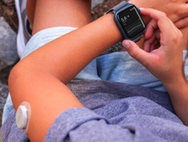How to connect a Dexcom 7 to an Apple Watch